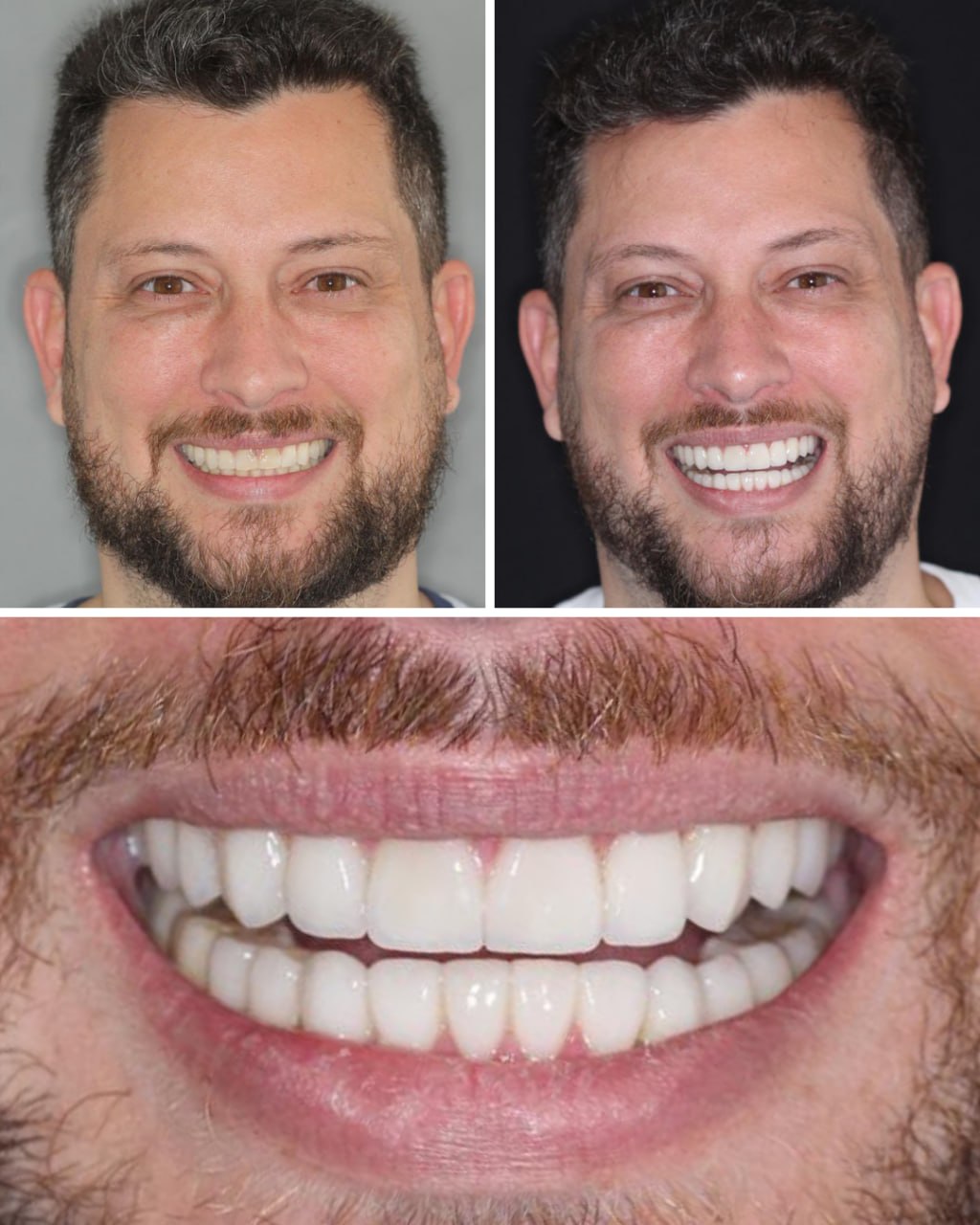 Transformação odontológica real